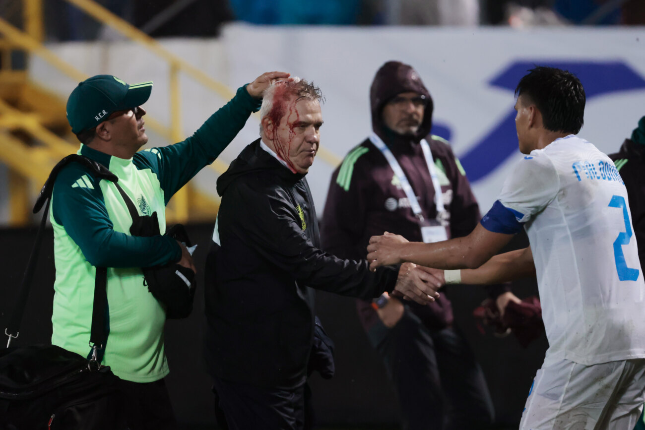 Aficionados hieren al técnico de México en partido que perdió ante Honduras