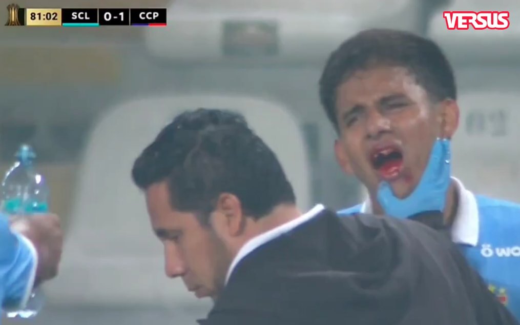 ¡El rival perdió un diente! Así fue la expulsión de Jonathan Torres