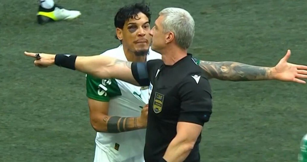 ¡Impactante! Gustavo Gómez juega en Palmeiras con un ojo "destrozado"